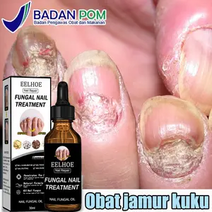 EELHOE Nail repair serum perawatan kuku 20g Krim Perbaikan Kuku Obat jamur kuku Obat kuku Perawatan kuku Obat kuku rusak