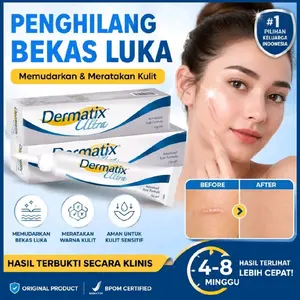 Dermatix Ultra 15gr Cream Penghilang Bekas Luka Keloid Jerawat