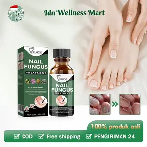 【100% Asli/Grosir】EELHOE Obat Jamur Kuku 30ml Nail Fungus Treatment Gel Anti Infeksi Obat Kuku Rusak Nail Fungus Removal Gel Kuku Rusak Obat Kuku Anti Infeksi Jamur Bakteri Bau Busuk Gatal Menguning Bernanah Memperbaiki Kuku Abu-Abu