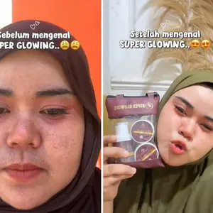 SUPER GLOWING NEW BPOM - Paket Lengkap Face Wash Sunscreen & Retinol Booster untuk Kulit Cerah dan Sehat