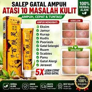 Salap Gatal Cina Ampuh Cap Orang Tua Atasi Gatal Eksim Kurap Kudis Jamus Alergi Ruam Prosiasis Kutu Air Gatal Selangkangan