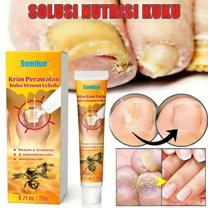 Nail Repair Cream 20g Krim Perbaikan Kuku Fungal Naml Treatment Against Nair Fungus Repair Nourishing Treatment Nail Melembutkan