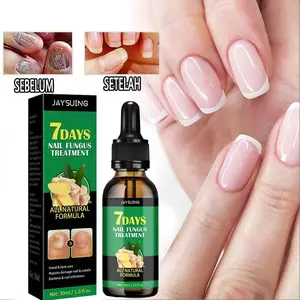 Perawatan Jamur Kuku 7 Days Nail Fungus Treatment Pengobatan Jamur Kuku & Perawatan Kuku Rusak Minyak Kutikula Jahe & Kunyit Menghidrasi & Memperbaiki Kuku Rusak Mengurangi Peradangan 30ml